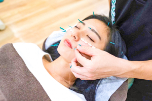 柔道整復院　ｊｕｄｏ－ｓｅｉｆｕｋｕｉｎ　桜台【鍼灸】の鍼灸の施術画像