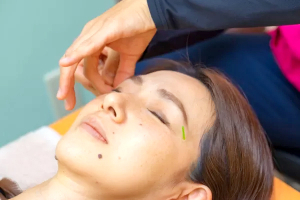 松戸駅西口整骨院の美容鍼施術の施術風景画像です。