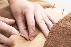 ＶＩＶＡ骨盤整体院　三田院の鍼灸施術の施術風景画像です。