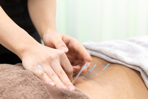 北２４条あおば鍼灸整骨院のはり師きゅう師の先生の画像です。