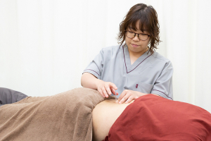 あい鍼灸院・接骨院　イオンタウン小阪院の鍼灸施術の施術風景画像です。