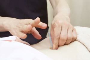 手あてん接骨院　イオンタウン守谷店【鍼灸】の鍼灸の施術画像