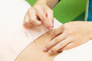 リセット整骨院　布施ほんまち通り院の鍼灸施術の画像