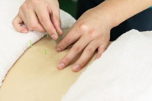 リセット整骨院　わかえいわた院の鍼灸施術の画像