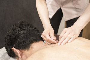 名古屋ハピネス鍼灸接骨院・整体院　名駅の肩こりの施術画像