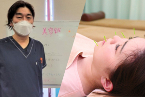 セントラル接骨院　西台の美容鍼の施術風景画像です。