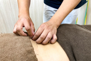 じん鍼灸整骨院　ゆいの杜院の鍼灸施術の施術風景画像です。