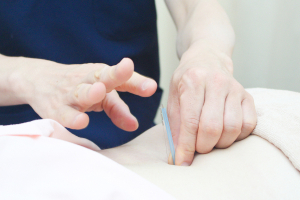 みのわ接骨院の鍼灸の施術風景画像です。