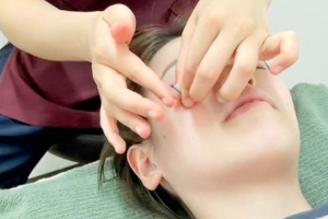 みのわ接骨院の美容鍼の施術風景画像です。