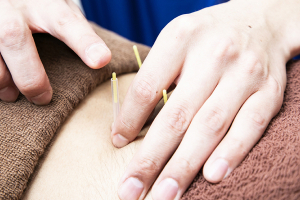 ＶＩＶＡ骨盤整体院　垂水院の鍼灸施術の施術風景画像です。