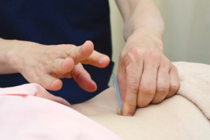 そら鍼灸接骨院　ジョイフル本田千葉ニュータウン店の鍼灸の施術画像