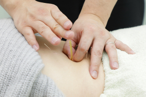 本厚木あおば整骨院はりきゅう院の鍼灸の施術風景画像です。