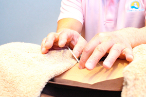 お台場ウェルケア鍼灸院の鍼灸施術の施術風景画像です。