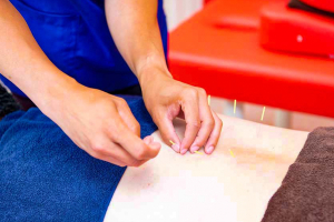 ＶＩＶＡ骨盤整体院　目黒院の鍼灸施術の施術風景画像です。