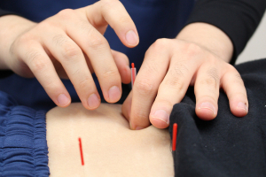 高円寺駅の接骨院・はり灸院の鍼灸施術の施術風景画像です。