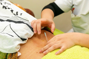 アール鍼灸接骨治療院　末広院の鍼灸の施術画像