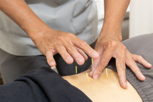 あい鍼灸院・接骨院　天六院の鍼灸施術の施術風景画像です。