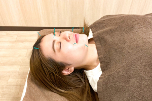 北越谷西口駅前鍼灸接骨院の鍼施術の施術風景画像です。