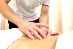 リセット整骨院　新石切院の鍼灸施術の施術風景画像です。