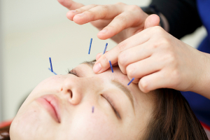 ＶＩＶＡ骨盤接骨院北長瀬院の鍼灸の施術画像