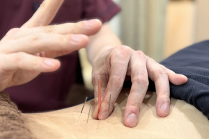 品川中延鍼灸整骨院・整体院の鍼灸施術の施術風景画像です。