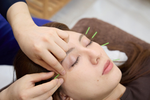 Ｂａｓｉｓ鍼灸整骨院　阿倍野駅・天王寺駅院の美容鍼の施術風景画像