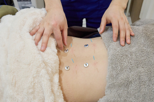 Ｂａｓｉｓ鍼灸整骨院　阿倍野駅・天王寺駅院の腰痛に対する施術風景画像