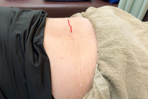 やまと鍼灸整骨院の腰痛の施術風景画像