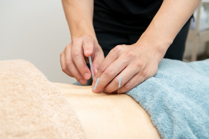 鍼灸院ワタ　中目黒院の腰痛の施術風景画像です。