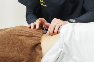 あおば接骨院はりきゅう院　ｍｉｎａｎｏｂａ相模原院の鍼灸施術の施術風景画像です。