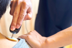 みめよい整骨院の肩こりに対する施術風景画像