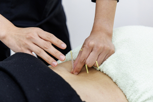 筑紫野あおば接骨院はりきゅう院の坐骨神経痛に対する施術風景画像です。