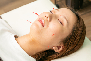 縁～ｅｎ～鍼灸整骨院　日根野院の美容鍼の施術風景画像