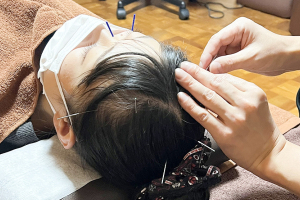 鍼灸治療院　医しん庵　堺市院の鍼灸の施術風景画像