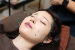 稲田堤たぬき鍼灸マッサージ治療院の鍼灸院の施術風景画像です。