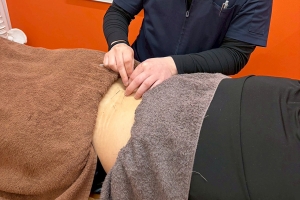 まいれ鍼灸整骨院・整体院　長浜院の鍼灸の施術風景画像です。