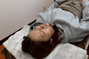 まいれ鍼灸整骨院・整体院　東近江院の顔のむくみ・小顔に対する施術風景画像です。