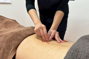 まいれ鍼灸整骨院・整体院　南草津院の鍼の施術風景画像です。
