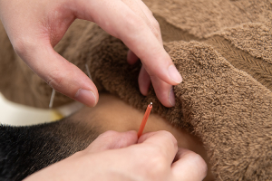 マーサ鍼灸整骨院　新小岩院の鍼灸の施術風景画像です。