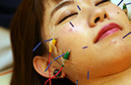 烏丸鍼灸整骨院施術工程step4