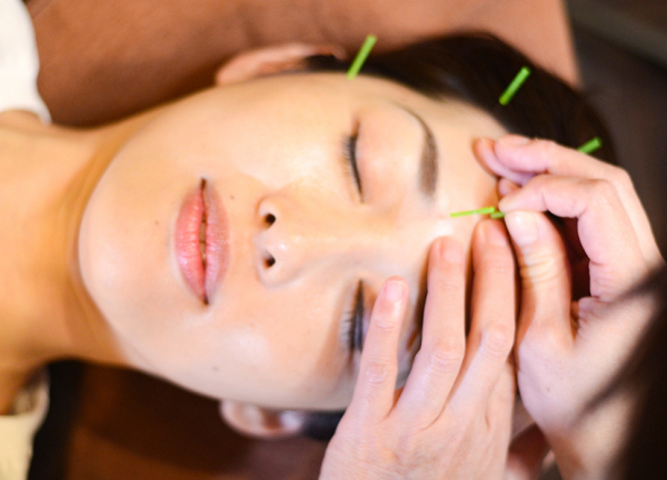 あかさか二丁目接骨院【鍼灸】(お顔の肌深層へアプローチします。)