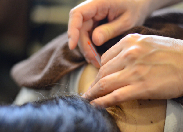 あかさか二丁目接骨院【鍼灸】(手技では届かない深部の筋肉は鍼でアプローチします。)