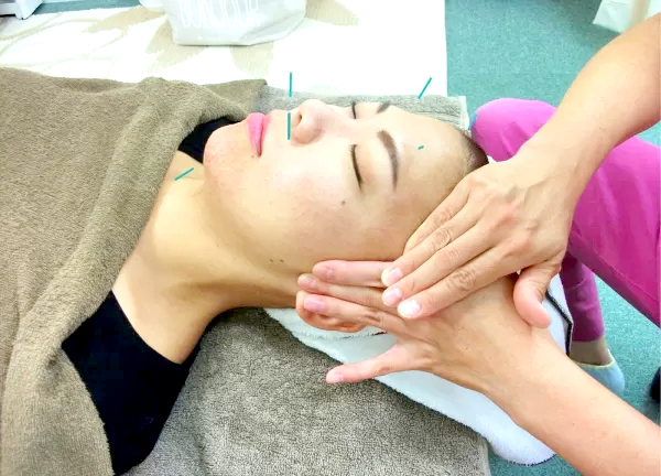 山中はりきゅう接骨院【マッサージ】(はりの施術)