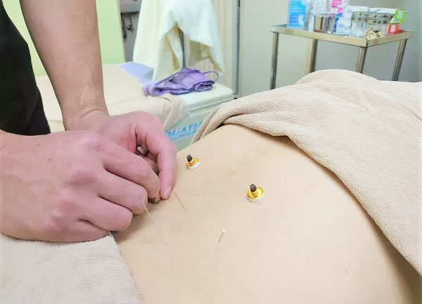 手あてん上郷接骨院【鍼灸】(局所的なつらい痛みは鍼の力にお任せください)