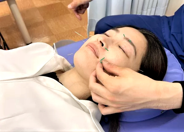 小林接骨院鍼灸院豊川(美容鍼に興味がある方、当院にてお試しください。)