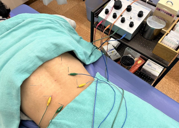 小林接骨院鍼灸院豊川(手技で緩和しない方は鍼灸をお試しください。)