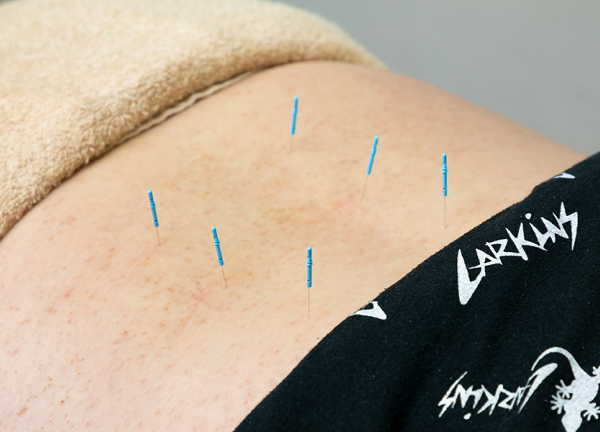 はばたき鍼灸整骨院(体内の流れを整えて健康的なお身体へ。)