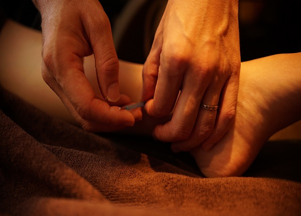 お子様向けの鍼施術も承ります。