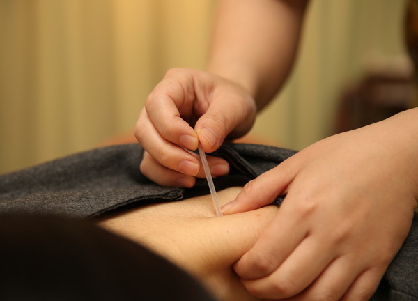 はりきゅうリラクゼーション治療院　治haru【鍼灸】(体の状態に合わせて鍼の深さを調節します)