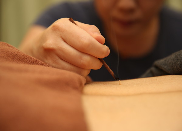 はりきゅうリラクゼーション治療院　治haru【鍼灸】(主に妊婦さん向け、直灸は線香で着火します)